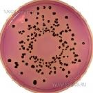 MLCB Agar (Mannitol Lysine Crystal violet Brilliant green)