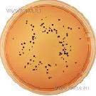 Desoxycholate Citrate Agar (Hynes)