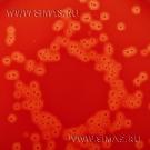 Blood Agar Base № 2